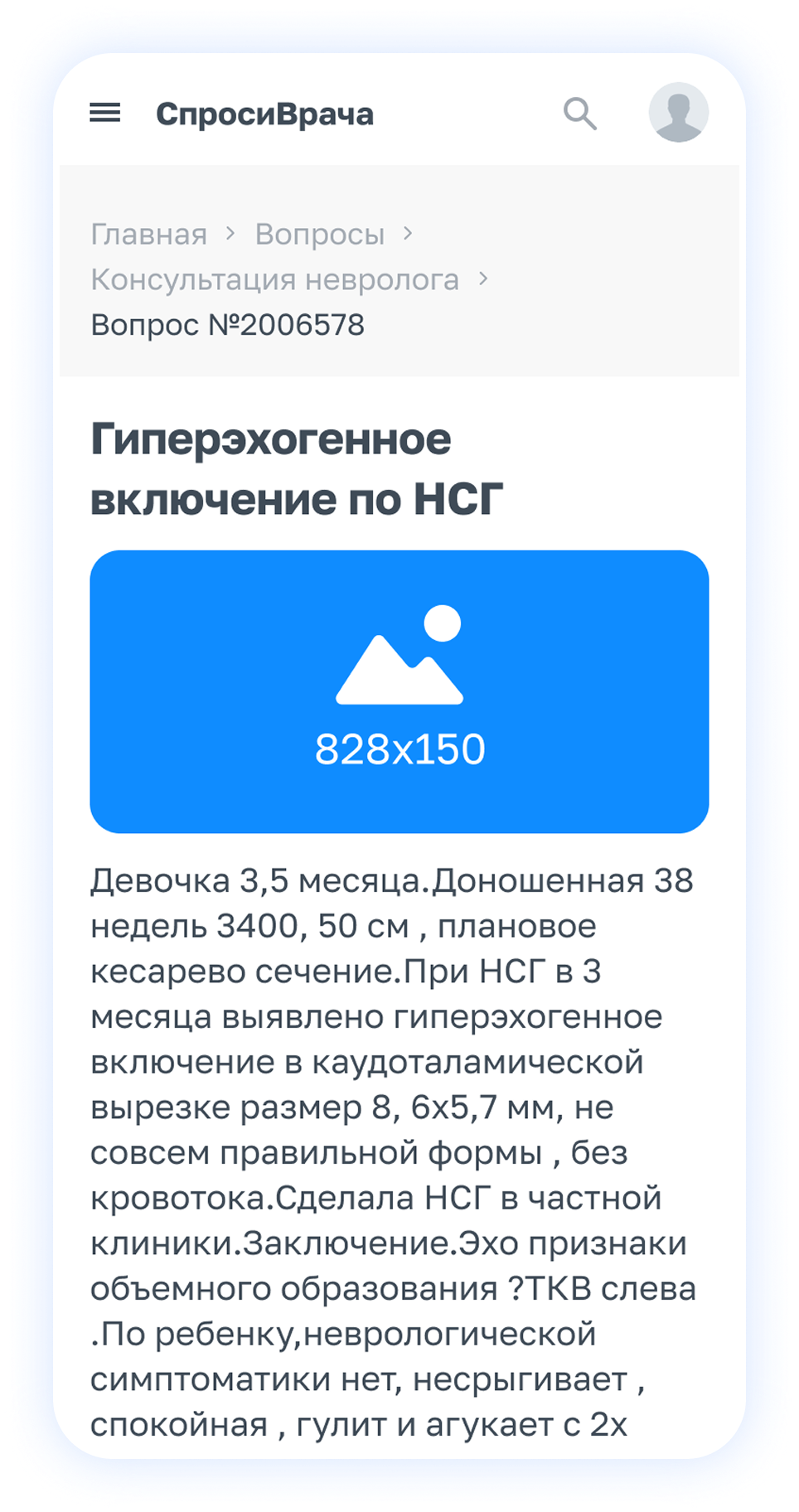 Пример баннера под заголовком вопроса на сайте СпросиВрача