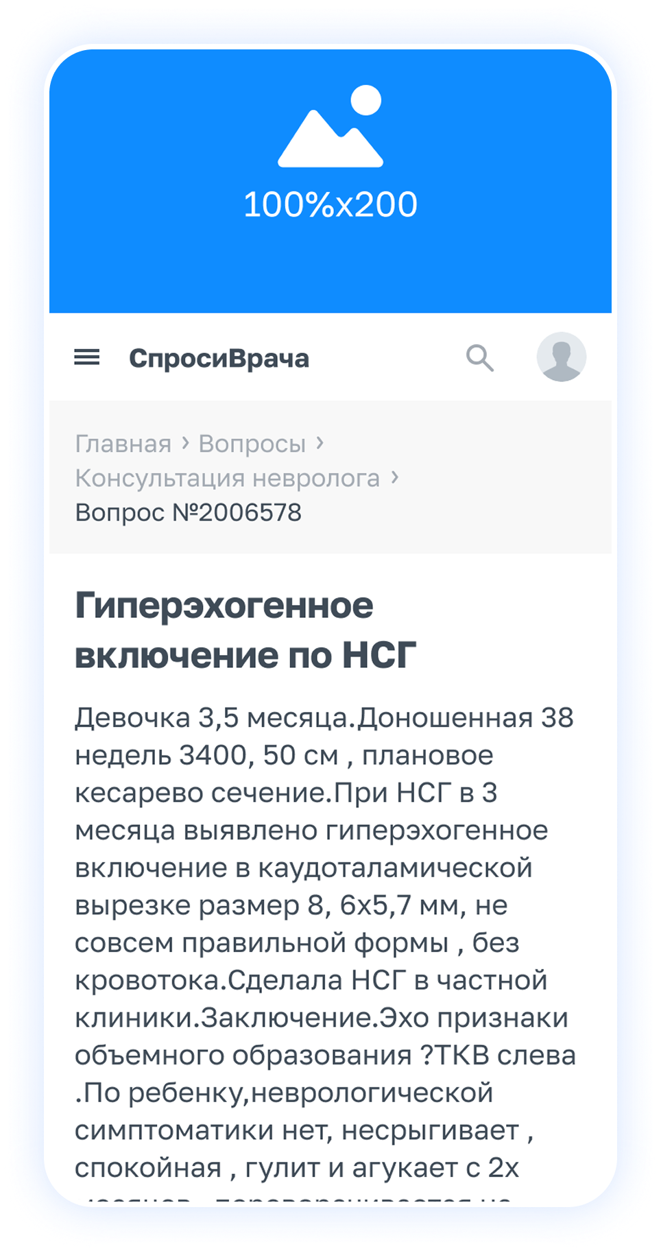 Пример верхней перетяжки на сайте СпросиВрача
